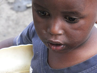 スラムに住む栄養失調児（ケニア）